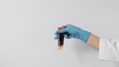 Nurse demonstrates two tubes with blood samples
