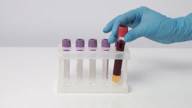 Putting two test tubes with blood samples in rack