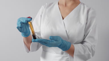 Assistant checking centrifuged blood plasma in test tube