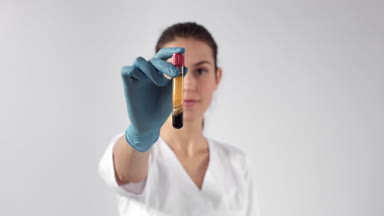 Cosmetologist demonstrates test-tube with blood plasma