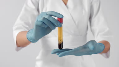 Doctor-cosmetologist demonstrates test-tube with blood plasma