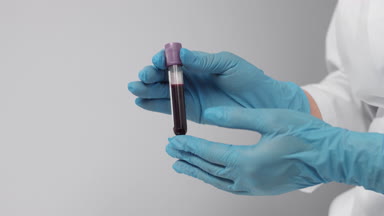 Assistant or nurse demonstrates blood sampling tube