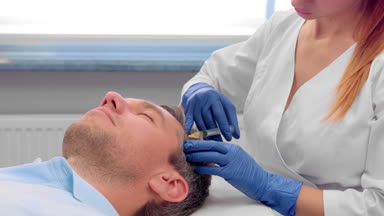 Platelet Rich Plasma injections for male hair rejuvenation