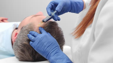 Close-up of platelet-rich plasma injections for hair loss