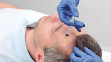 Close-up of Platelet Rich Plasma treatment for hair rejuvenation