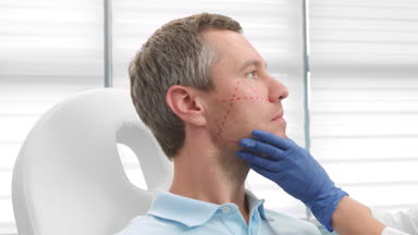 Marking the patient's face before the beauty treatment #J8IC082n