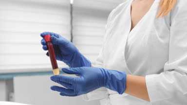 Assistant holds vacuum blood tube with blood sample