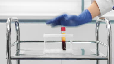 Vacuum blood sample tube with centrifuged blood sample.