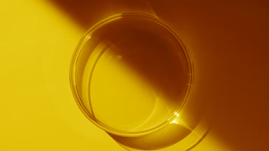 Top view of Petri dish appear from shadow on yellow background