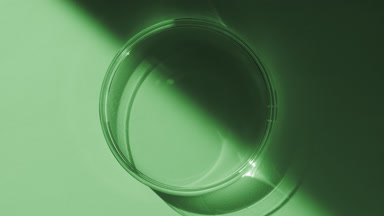 Top view of Petri dish appear from shadow on green background