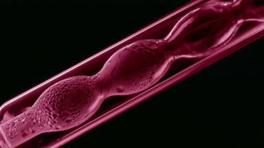 Pink liquid condensing on bulb lab condenser, black background